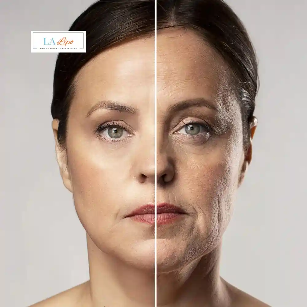 How Can You Tell If Non-Surgical Skin Tightening Is Right for You Crystal Palace?