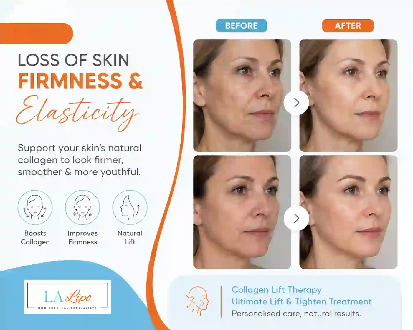 Sign #7: Loss of Skin Firmness and Elasticity Crystal Palace